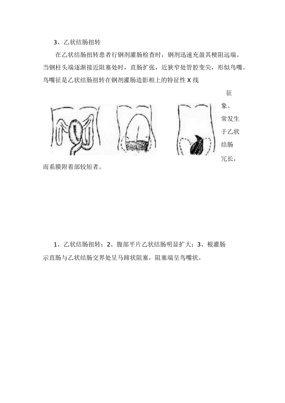 主动脉夹层、乙状结肠扭转、贲门失弛缓症、Chiari II型畸形、Chiari II型畸形等鸟嘴征病变疾病影像学临床表现.docx_第3页