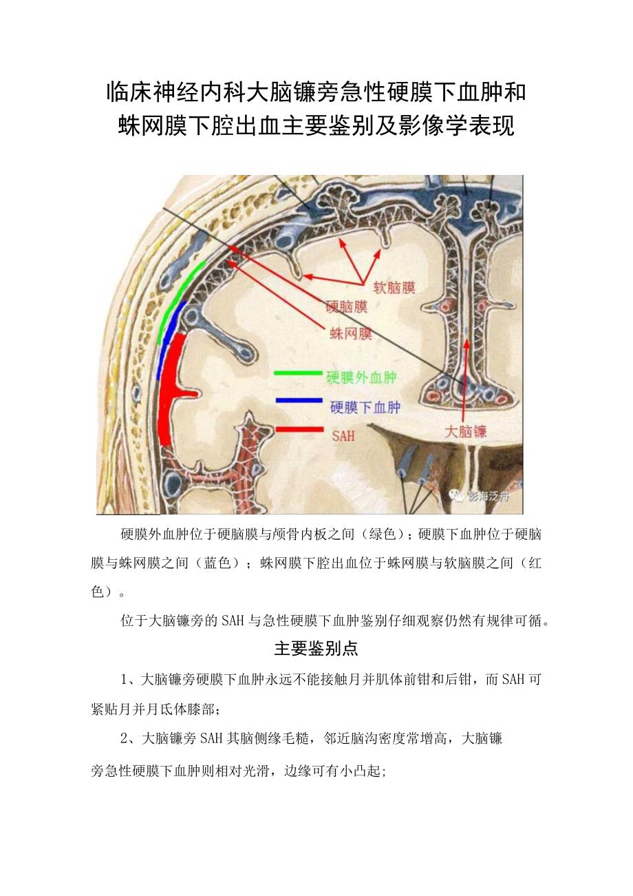 临床神经内科大脑镰旁急性硬膜下血肿和蛛网膜下腔出血主要鉴别及影像学表现.docx_第1页