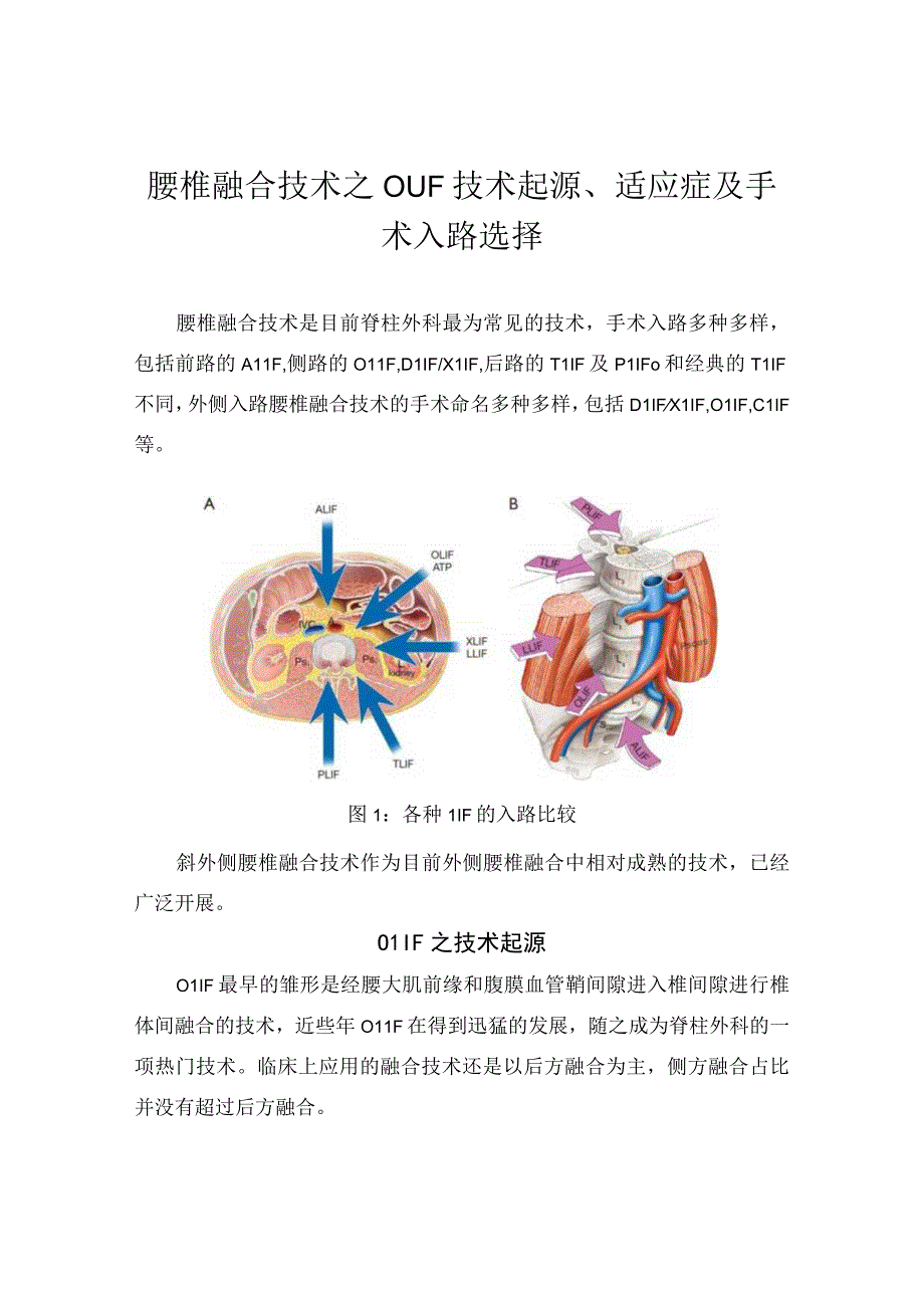 腰椎融合技术之OLIF技术起源、适应症及手术入路选择.docx_第1页