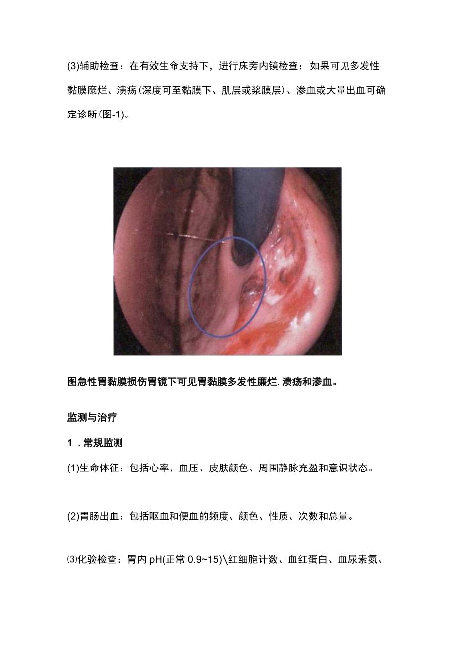 最新：急性胃黏膜损伤.docx_第2页