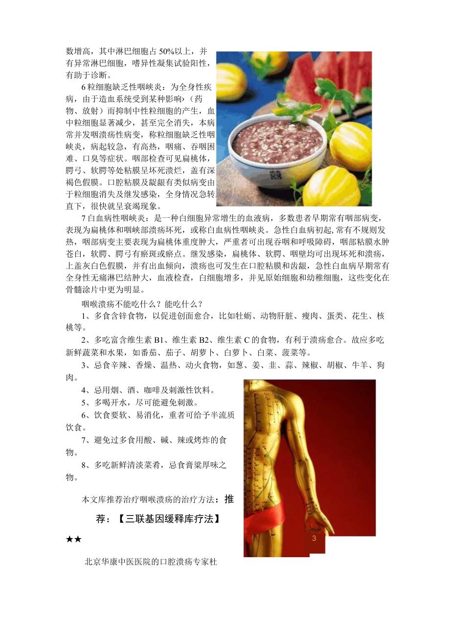 咽喉溃疡怎么治疗？咽喉溃疡的治疗方法？.docx_第2页