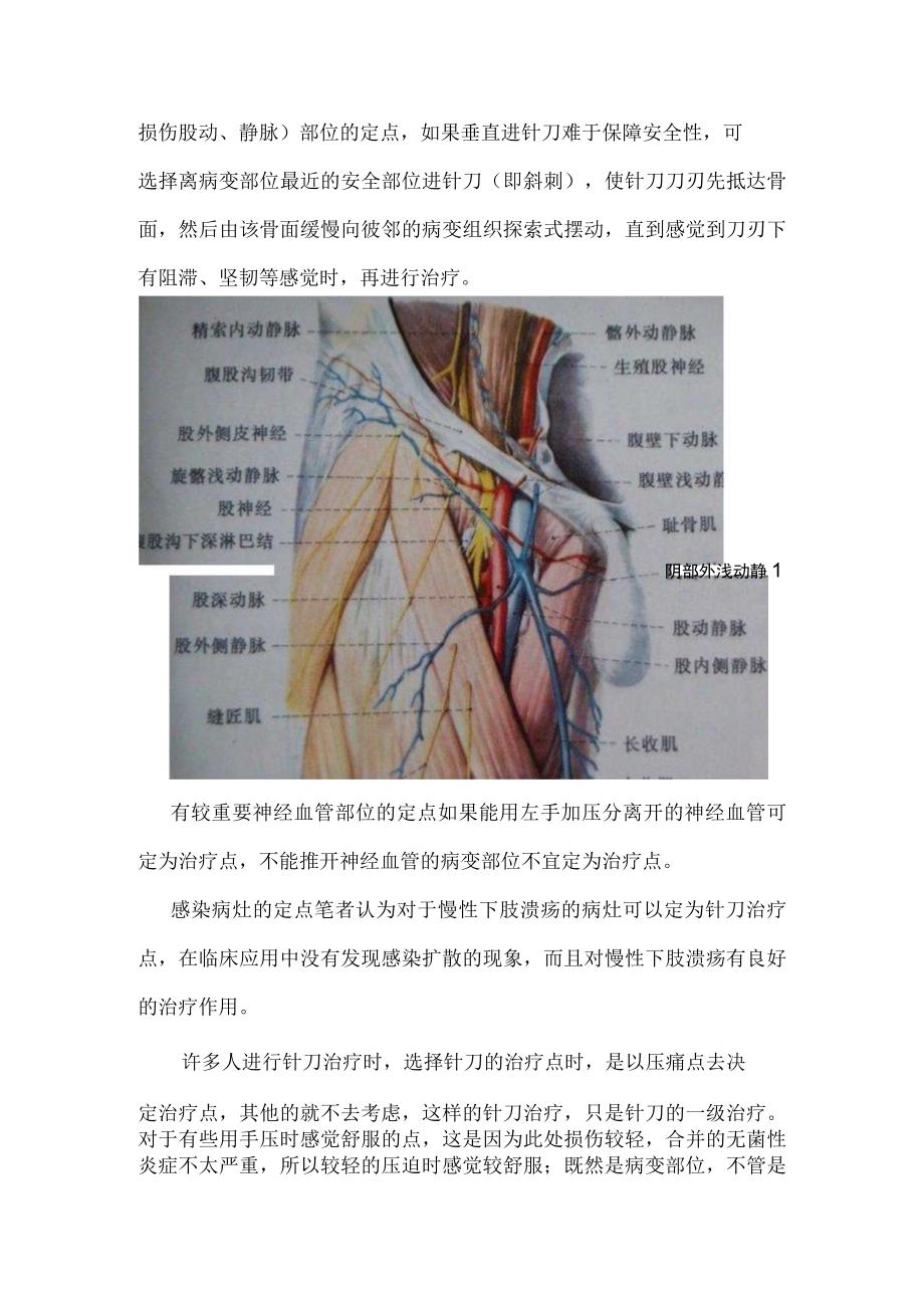 针刀闭合性手术的操作规程、手术方法、操作技法副本.docx_第3页