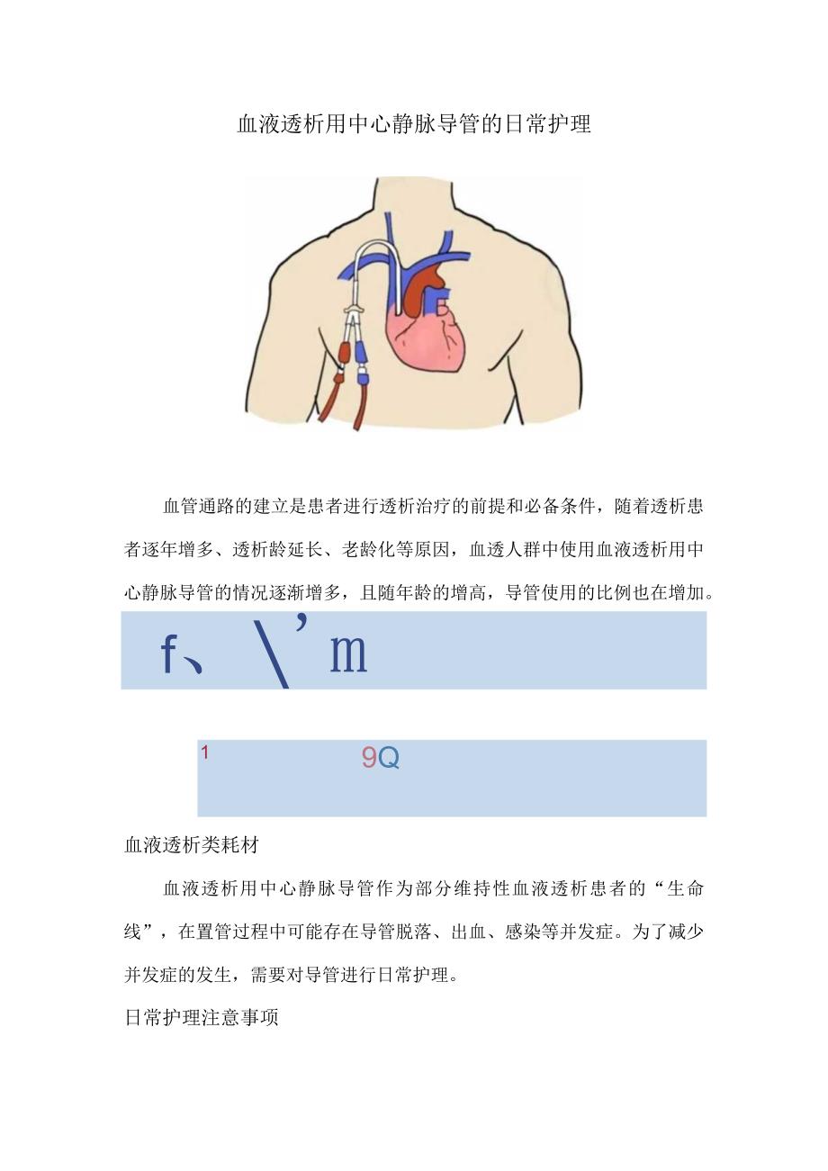 血液透析用中心静脉导管的日常护理.docx_第1页