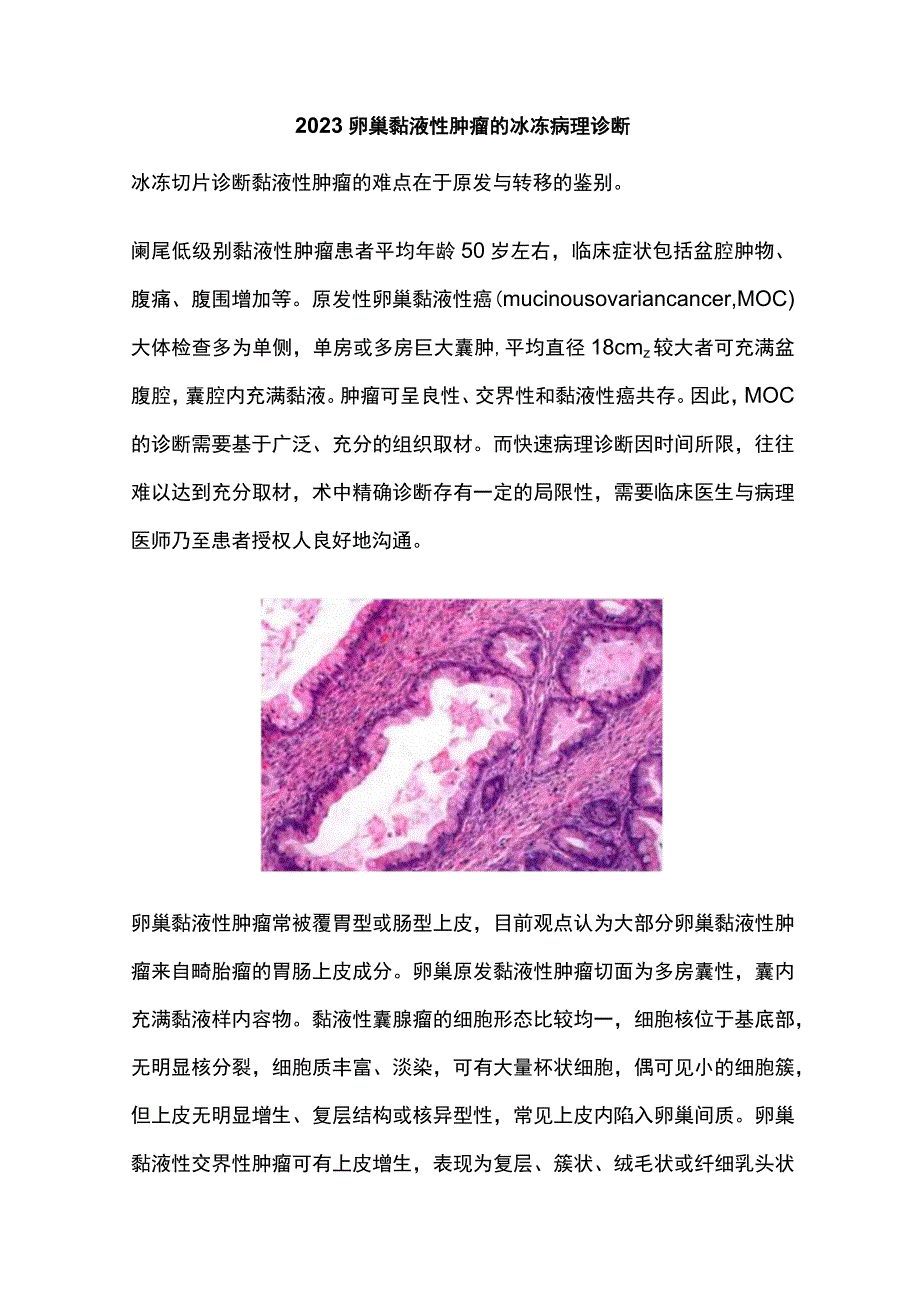 2023卵巢黏液性肿瘤的冰冻病理诊断.docx_第1页