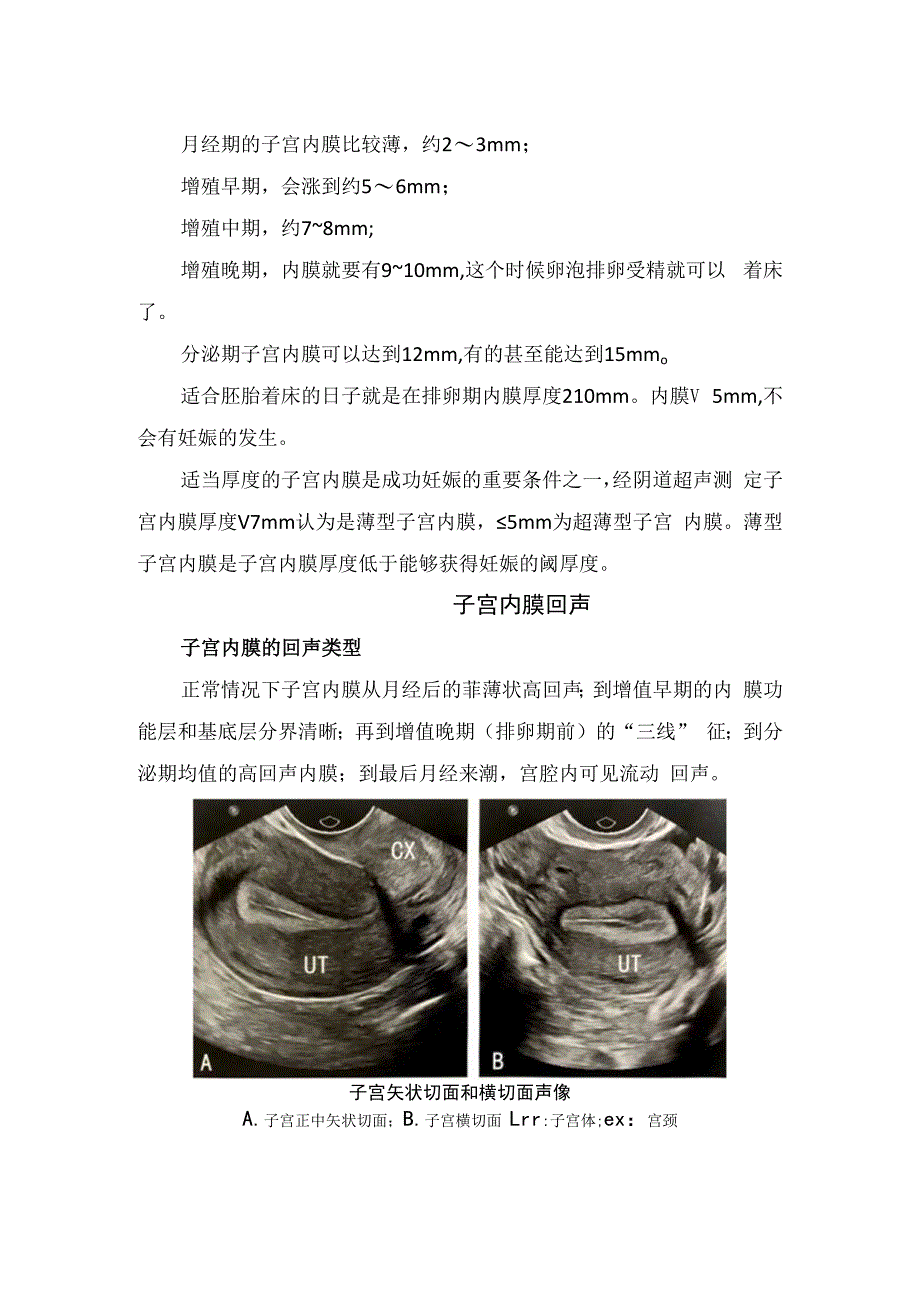 内膜厚度、内膜回声、内膜容积、子宫动脉及内膜下血流指标标准、注意要点及影像表现.docx_第2页