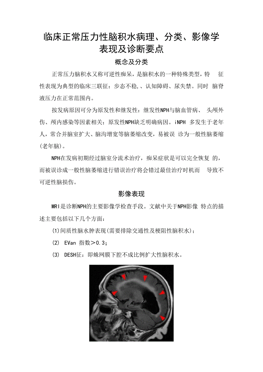 临床正常压力性脑积水病理、分类、影像学表现及诊断要点.docx_第1页