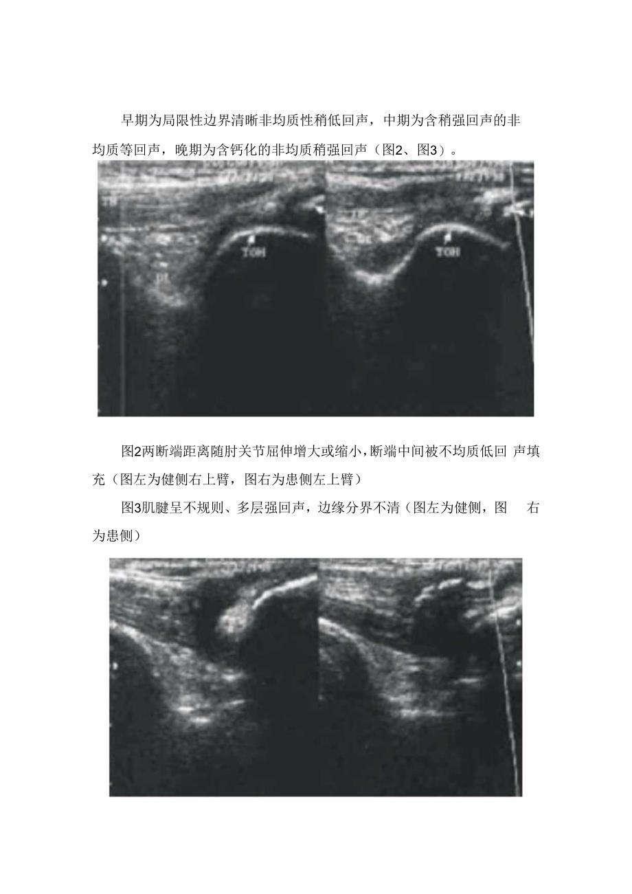 临床甲氧氯普胺使用孕吐、乳腺肿瘤、消化道出血、晕动症、山莨菪碱联用、地高辛合用、氯丙嗪合用、静脉滴注等合理使用问题解读.docx_第2页