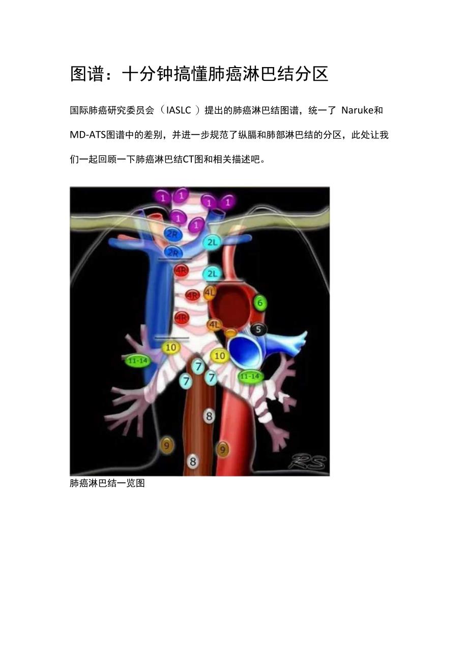 图谱：十分钟搞懂肺癌淋巴结分区.docx_第1页