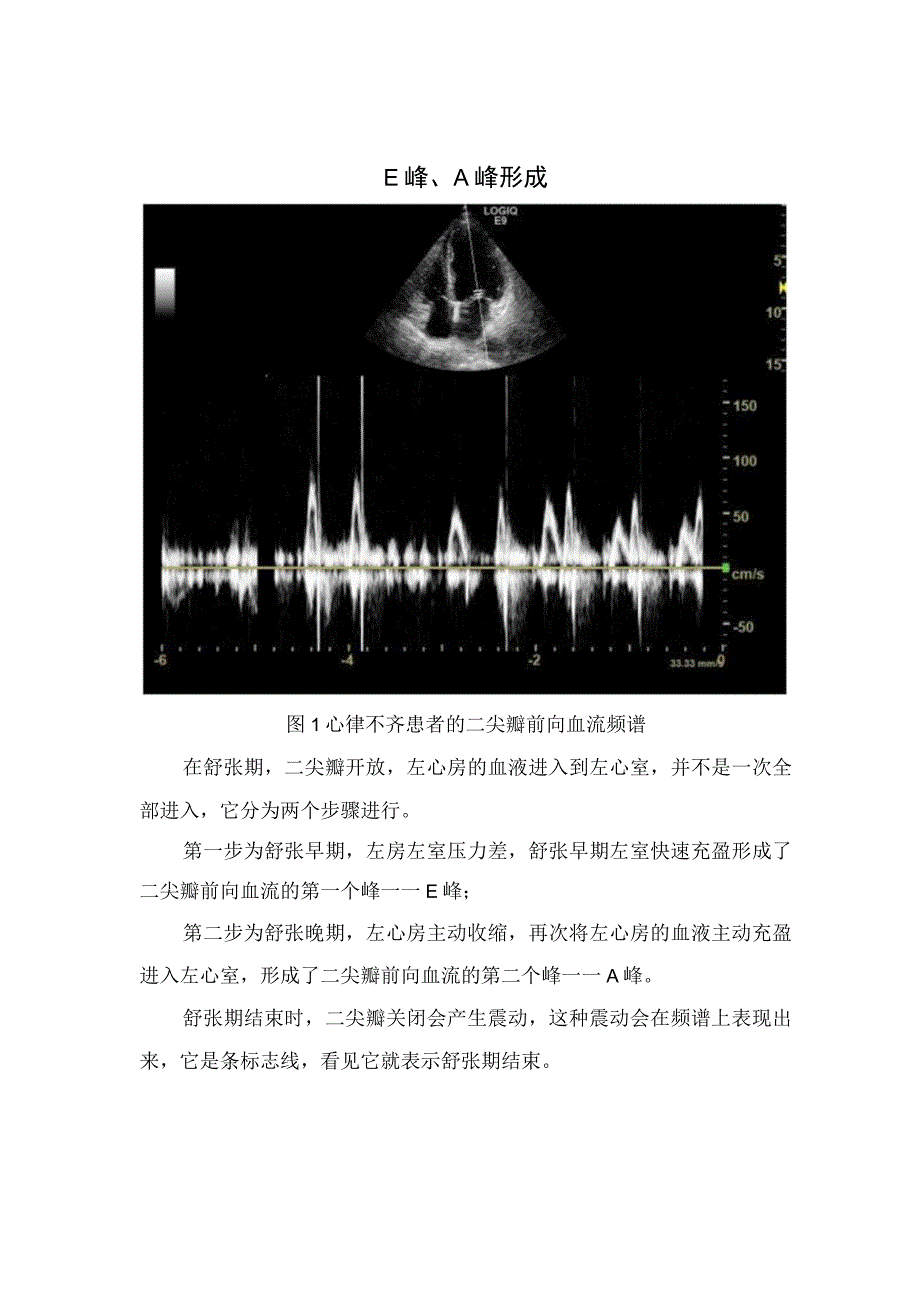 E峰、A峰形成原因及频谱技巧.docx_第1页