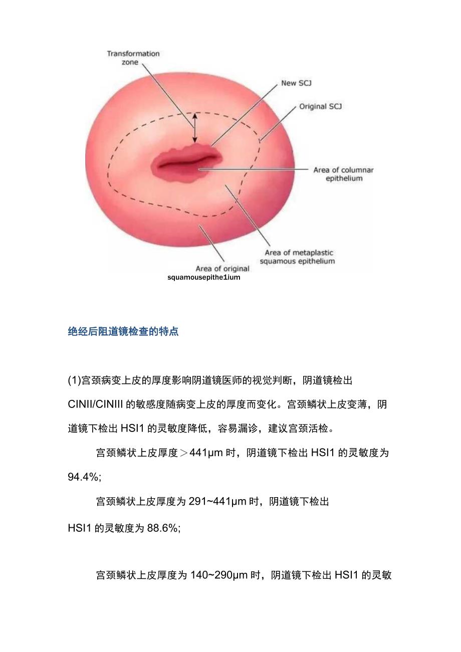 2023绝经期女性阴道镜特点及操作技巧.docx_第3页