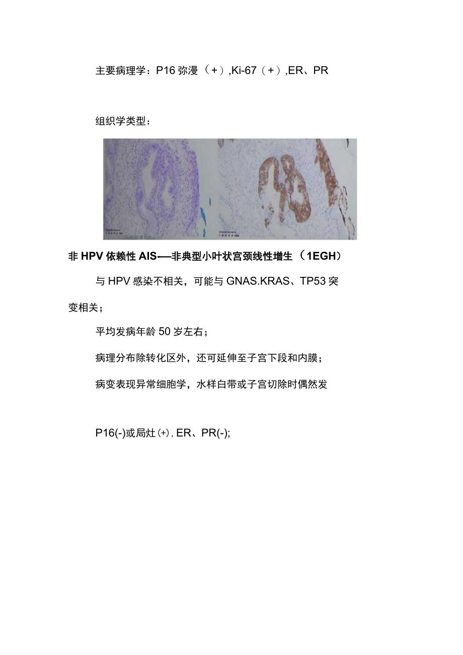 2023宫颈腺性病变的阴道镜检查.docx_第2页