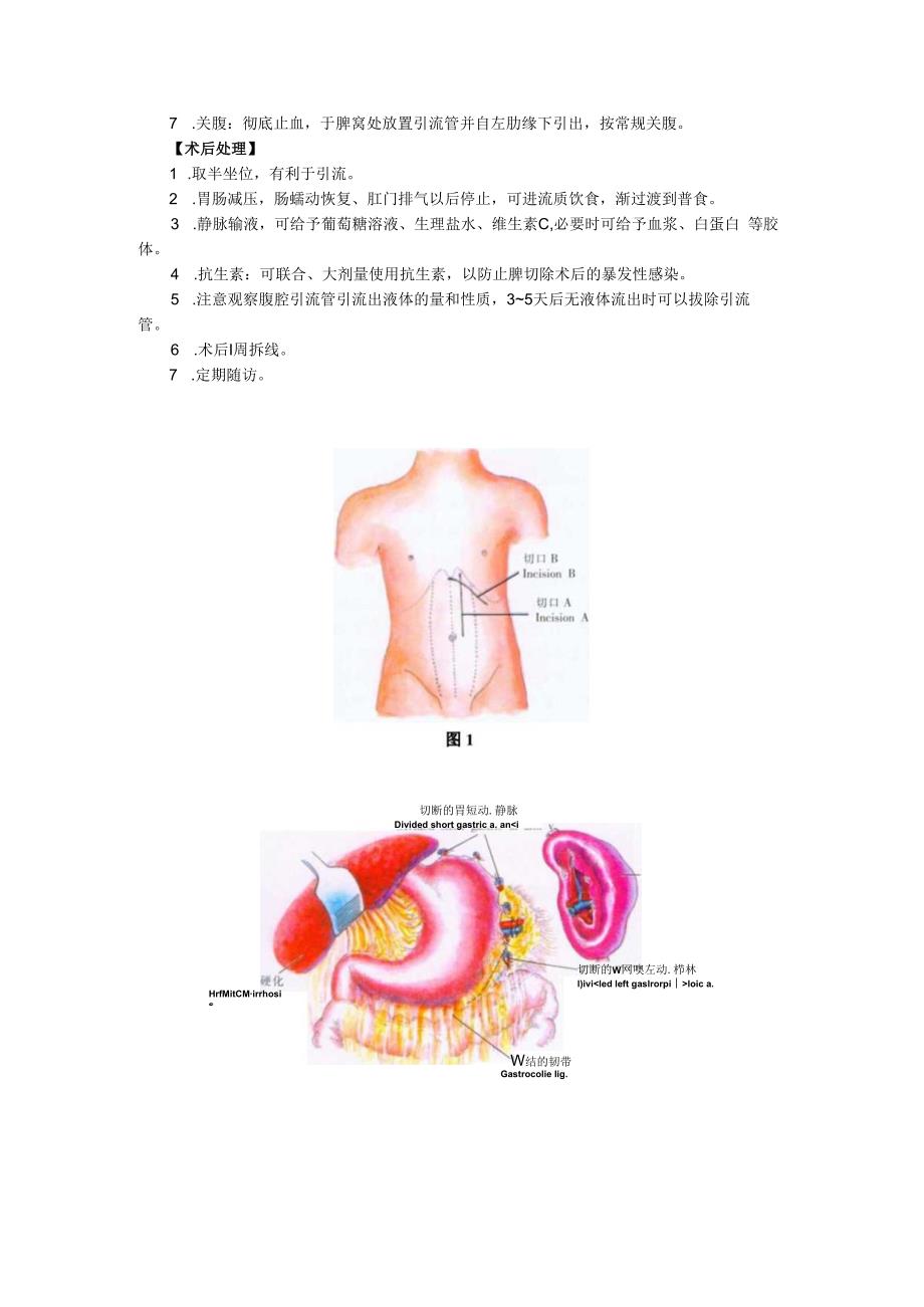 手术图谱资料：经腹胃底静脉断流术.docx_第2页