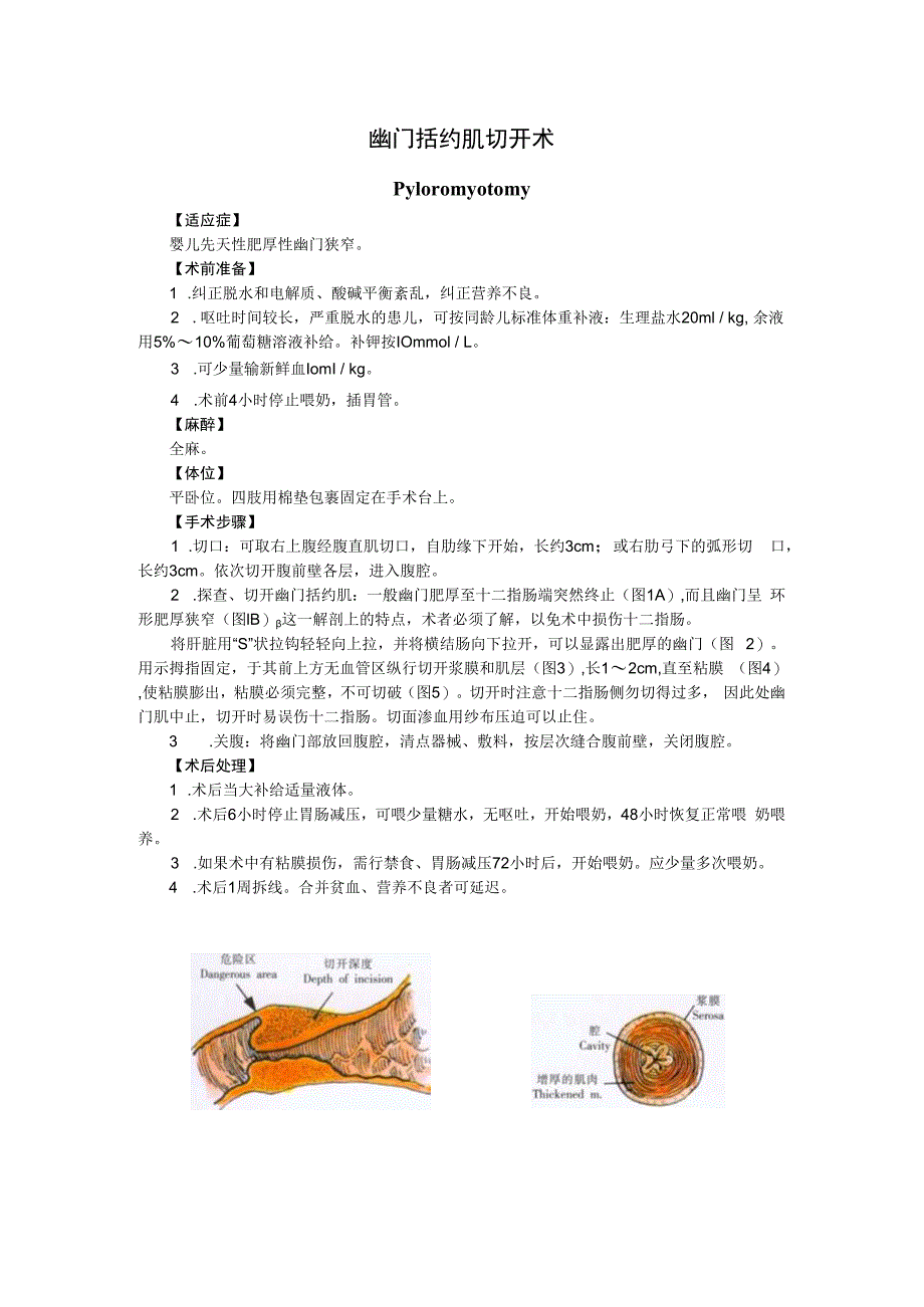 手术图谱资料：幽门括约肌切开术.docx_第1页