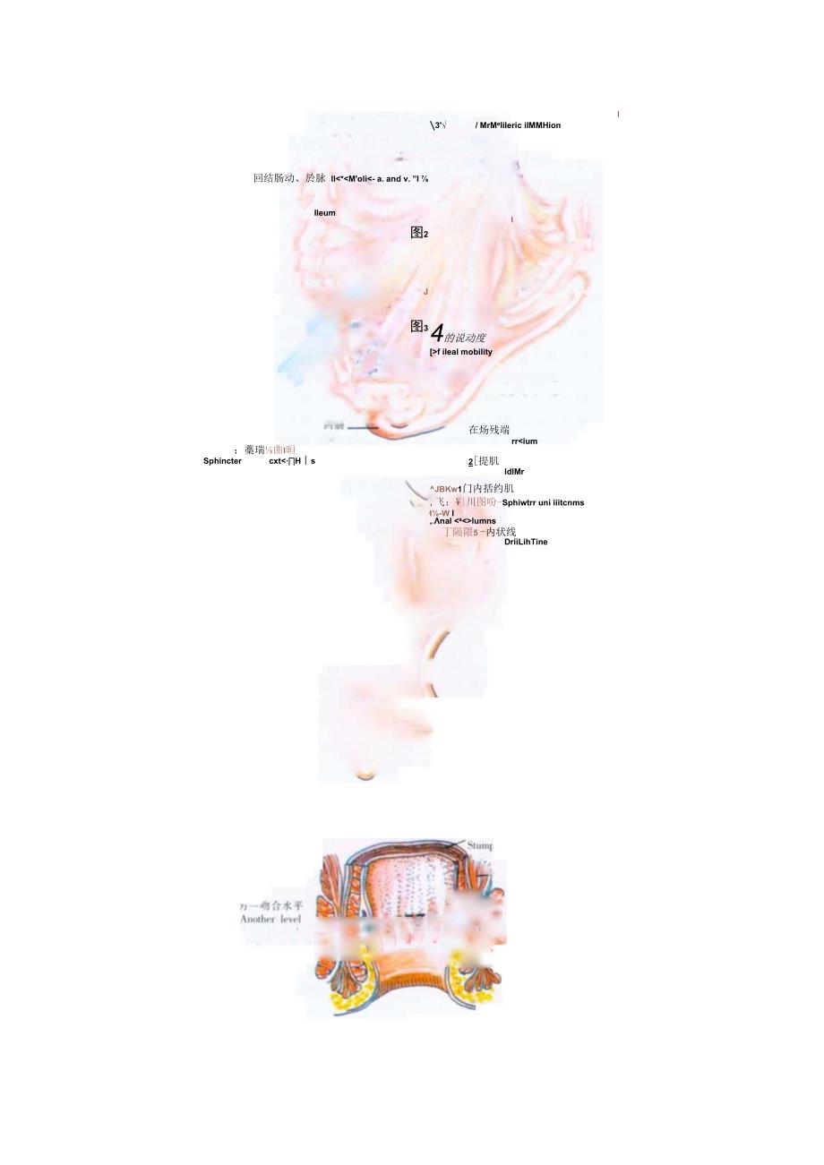 手术图谱资料：回肠、肛管吻合术.docx_第3页