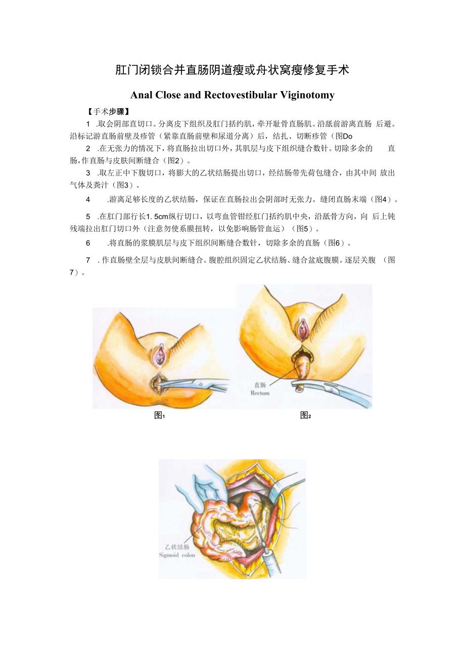 手术图谱资料：肛门闭锁合并直肠阴道瘘或舟状窝瘘修复手术.docx_第1页