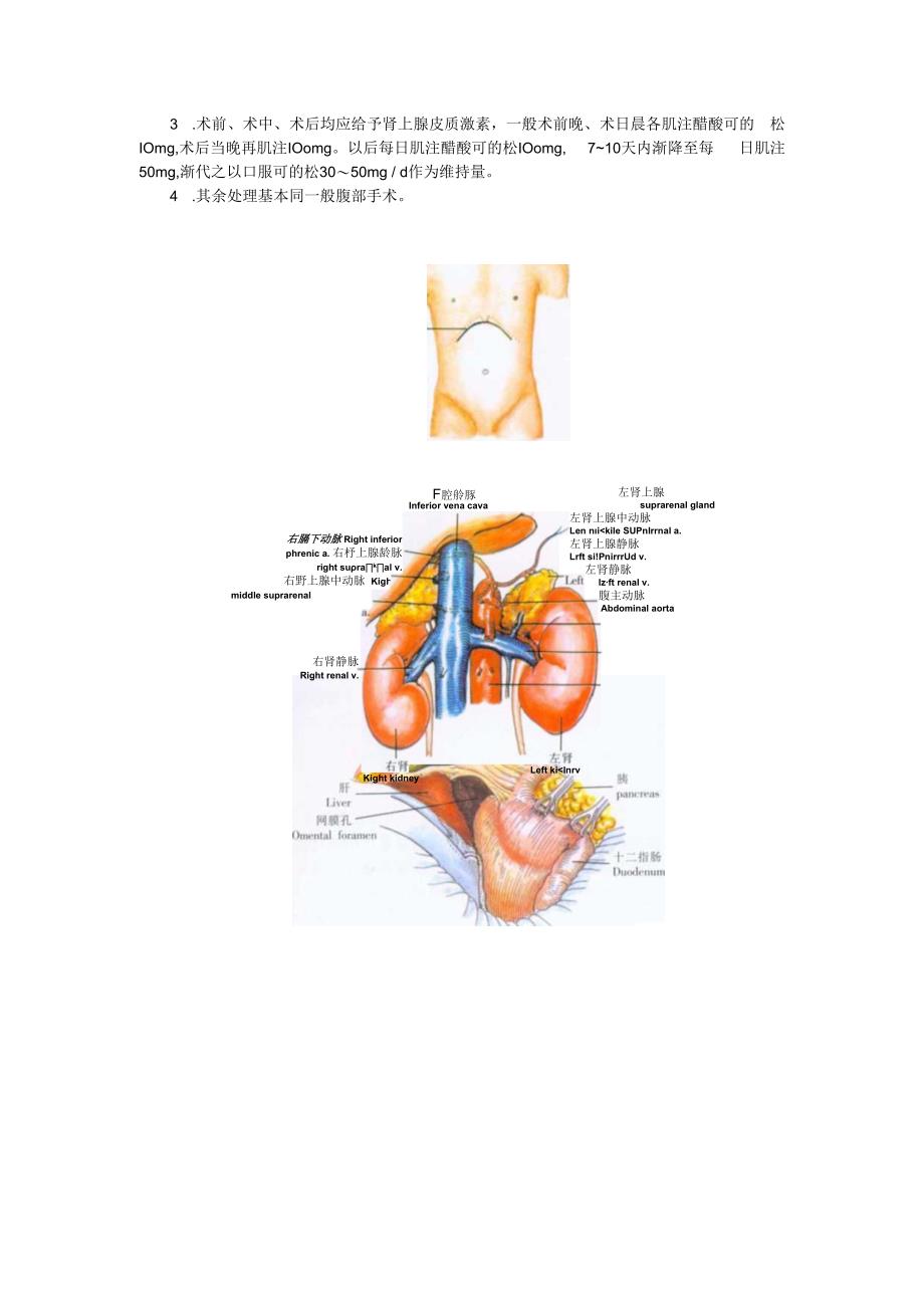 手术图谱资料：双侧肾上腺切除术.docx_第2页