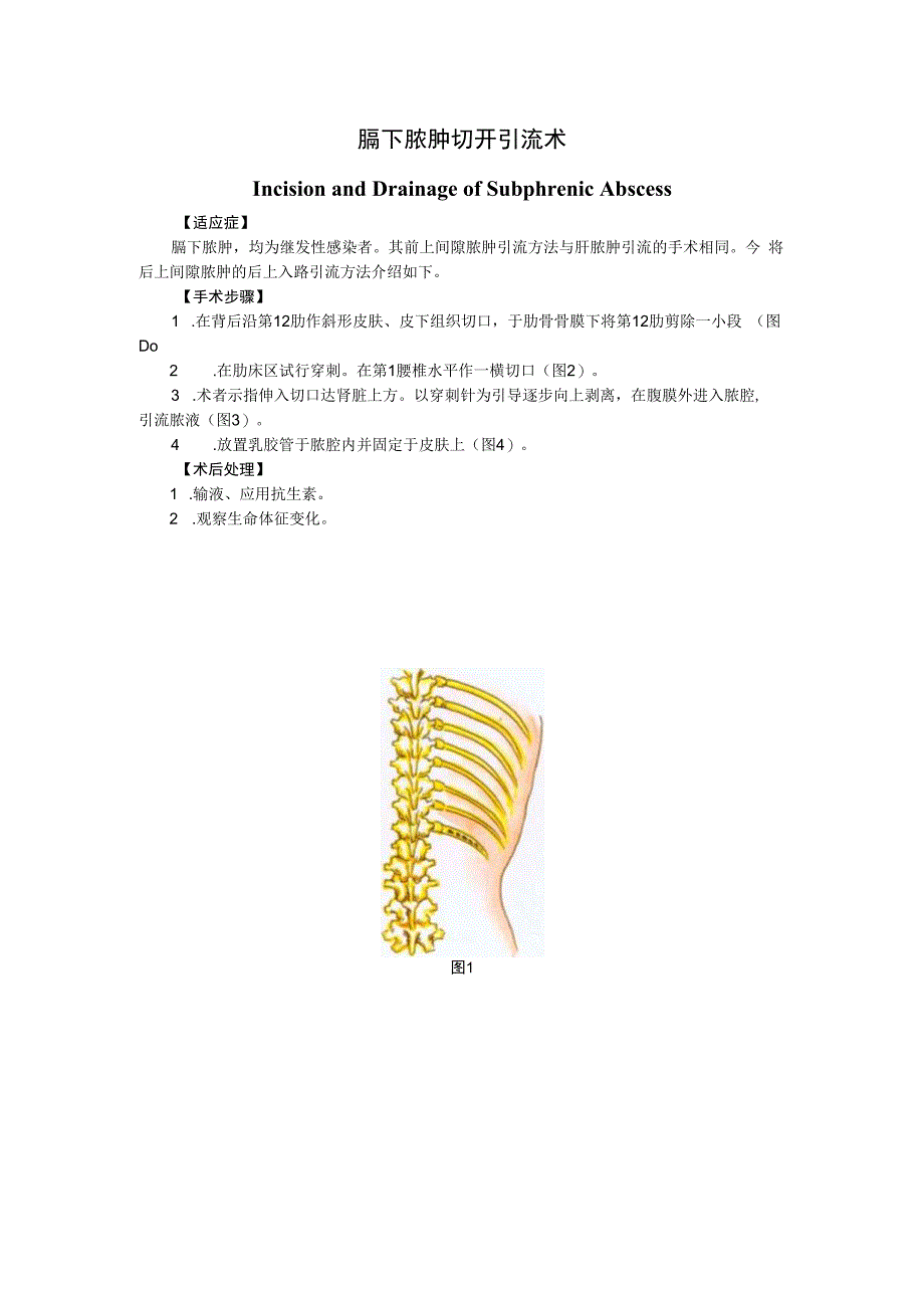 手术图谱资料：膈下脓肿切开引流术.docx_第1页