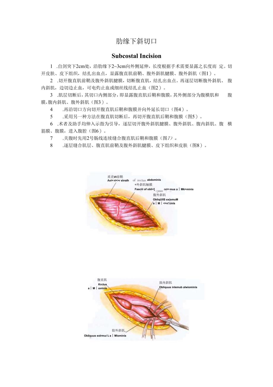 手术图谱资料：肋缘下斜切口.docx_第1页