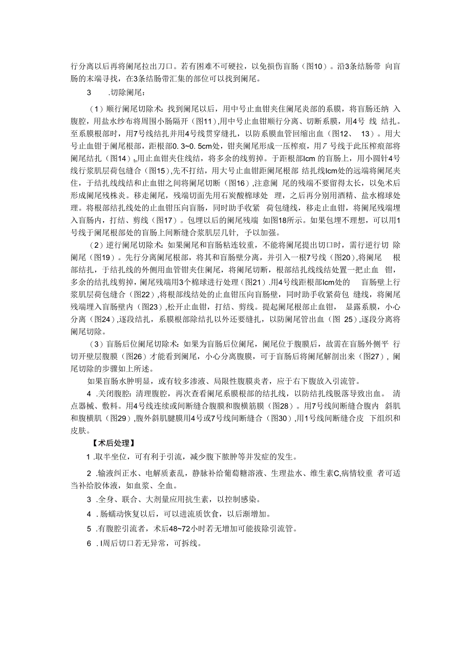 手术图谱资料：阑尾切除术.docx_第2页