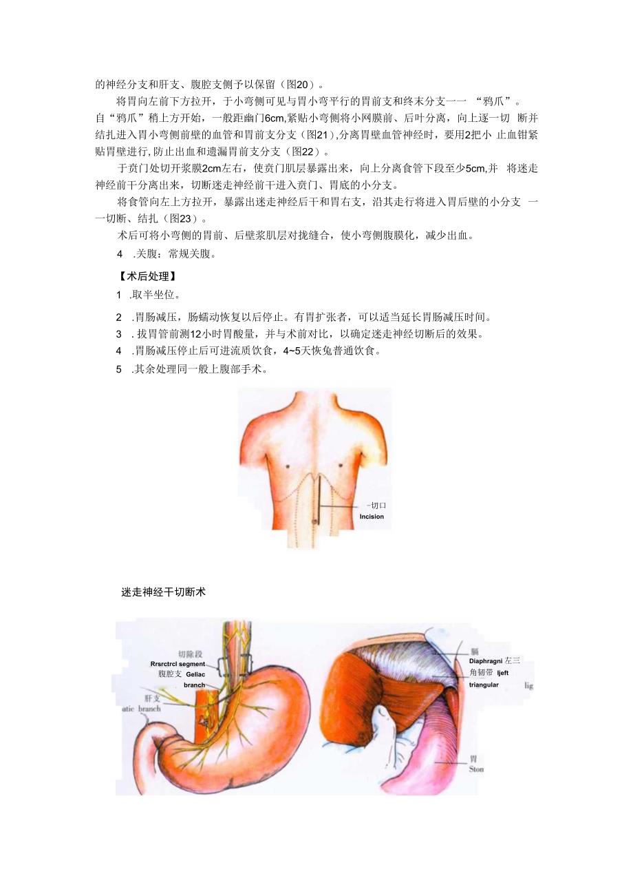 手术图谱资料：迷走神经切断术.docx_第2页