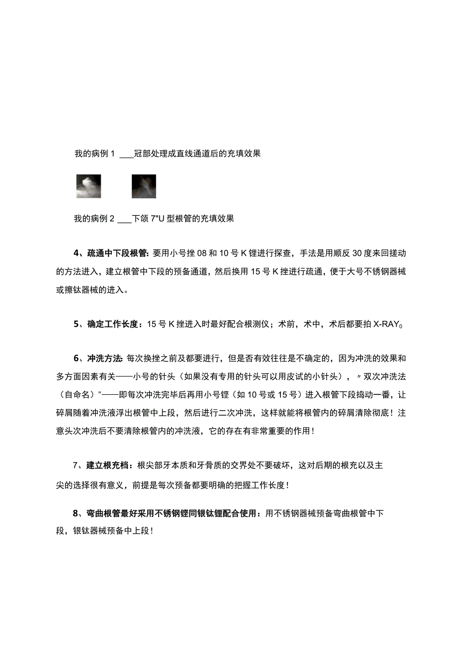 牙周牙髓综合征根管治疗图解.docx_第2页