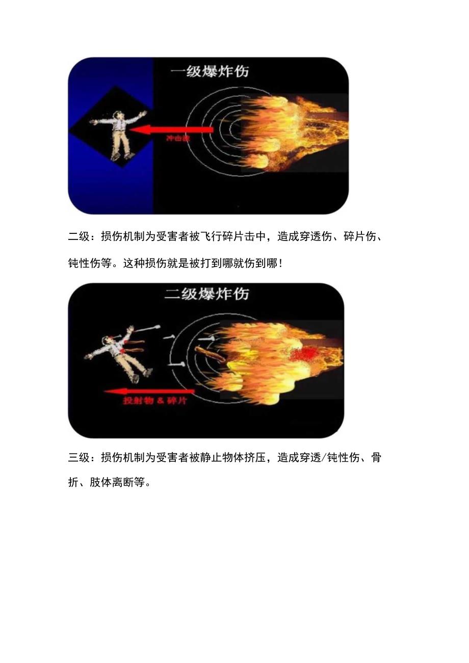 爆炸现场可能会用到的急救知识.docx_第2页