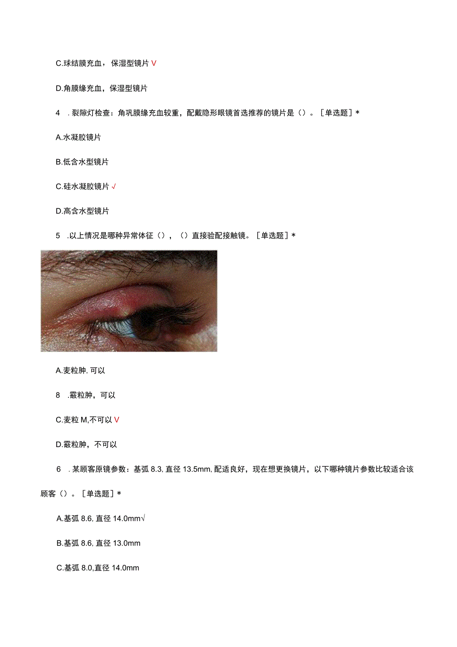 2023软性角膜接触镜考核试题.docx_第2页