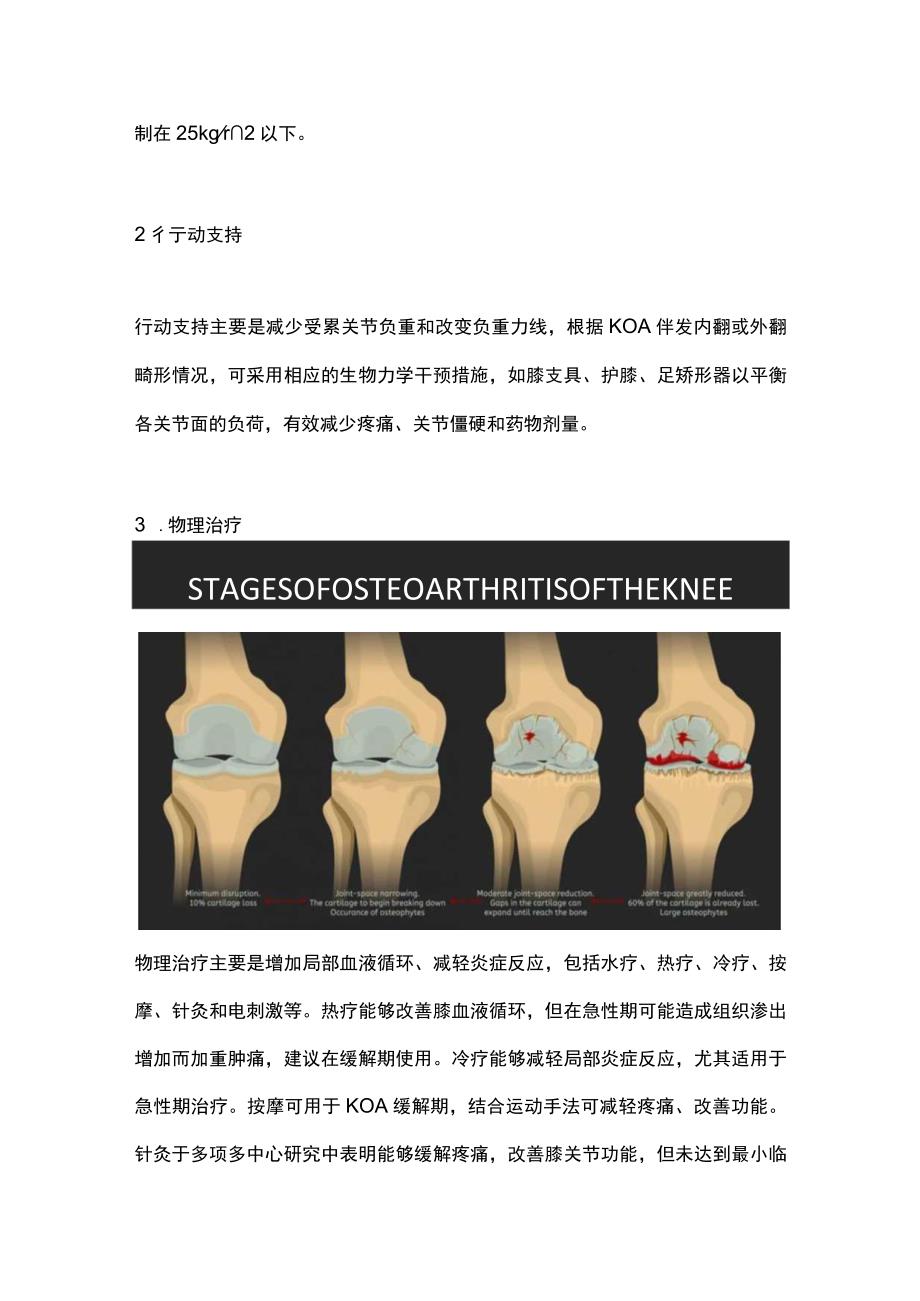 2023膝骨关节炎的防护与阶梯化治疗.docx_第2页