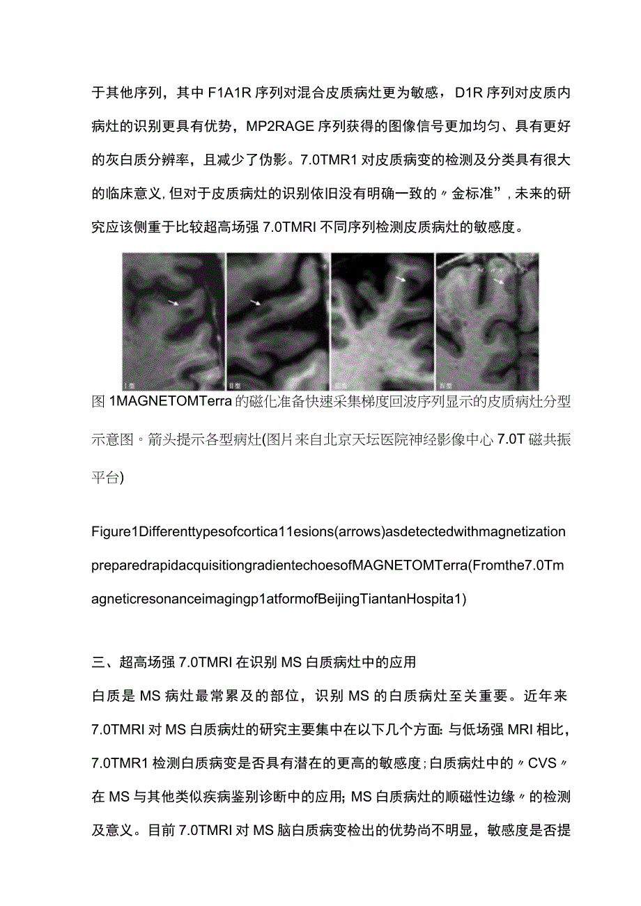 2023超高场强7.0 T磁共振成像在多发性硬化中的研究进展.docx_第3页