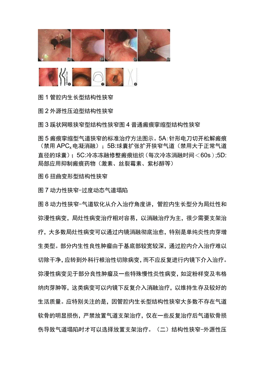 2023良性气道疾病呼吸介入操作的规范性要求.docx_第3页