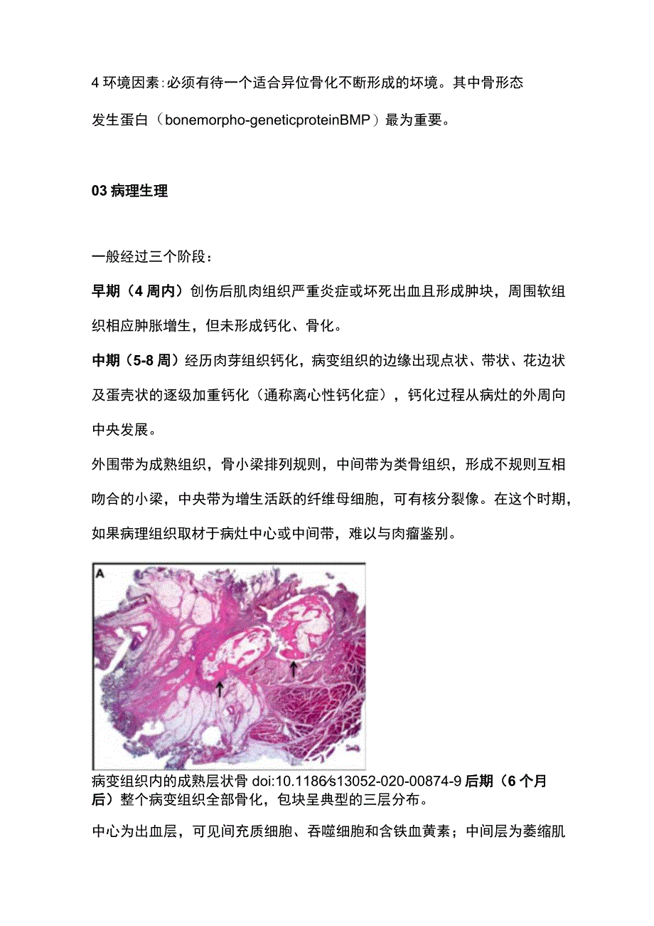 2023骨化性肌炎研究进展.docx_第2页