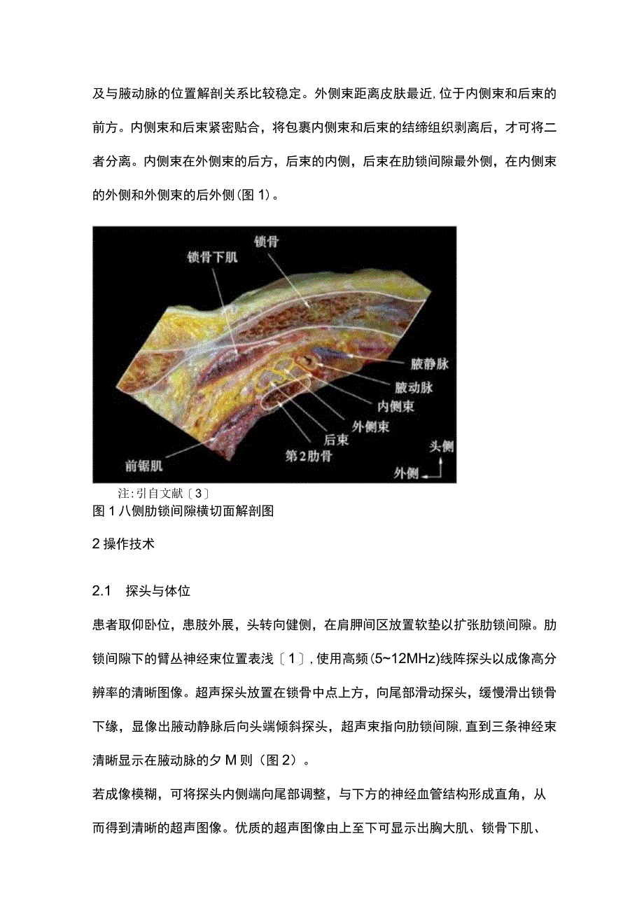 最新：肋锁间隙入路臂丛神经阻滞的研究进展.docx_第2页