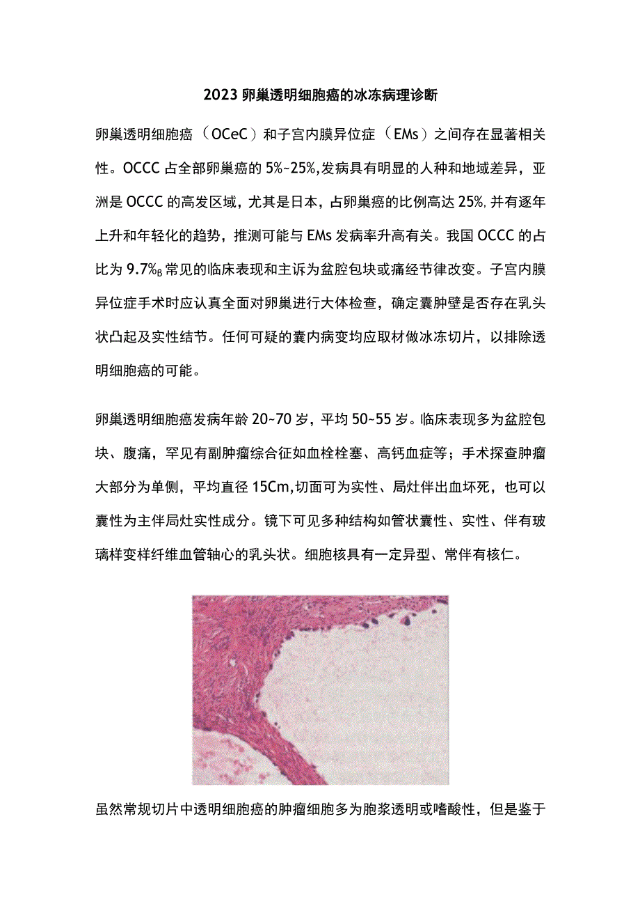 2023卵巢透明细胞癌的冰冻病理诊断.docx_第1页