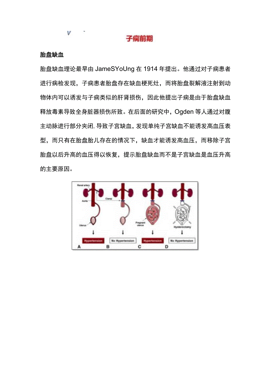 2023子痫前期病因学.docx_第2页