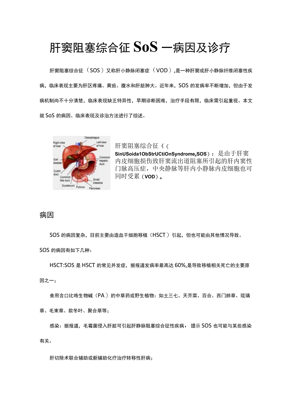 肝窦阻塞综合征SOS病因及诊疗.docx_第1页