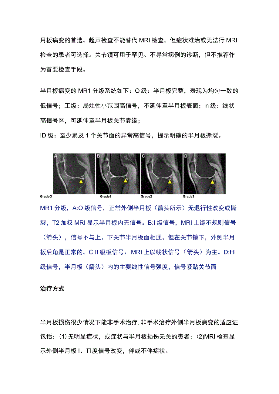 2023外侧半月板病变的诊断与治疗.docx_第3页