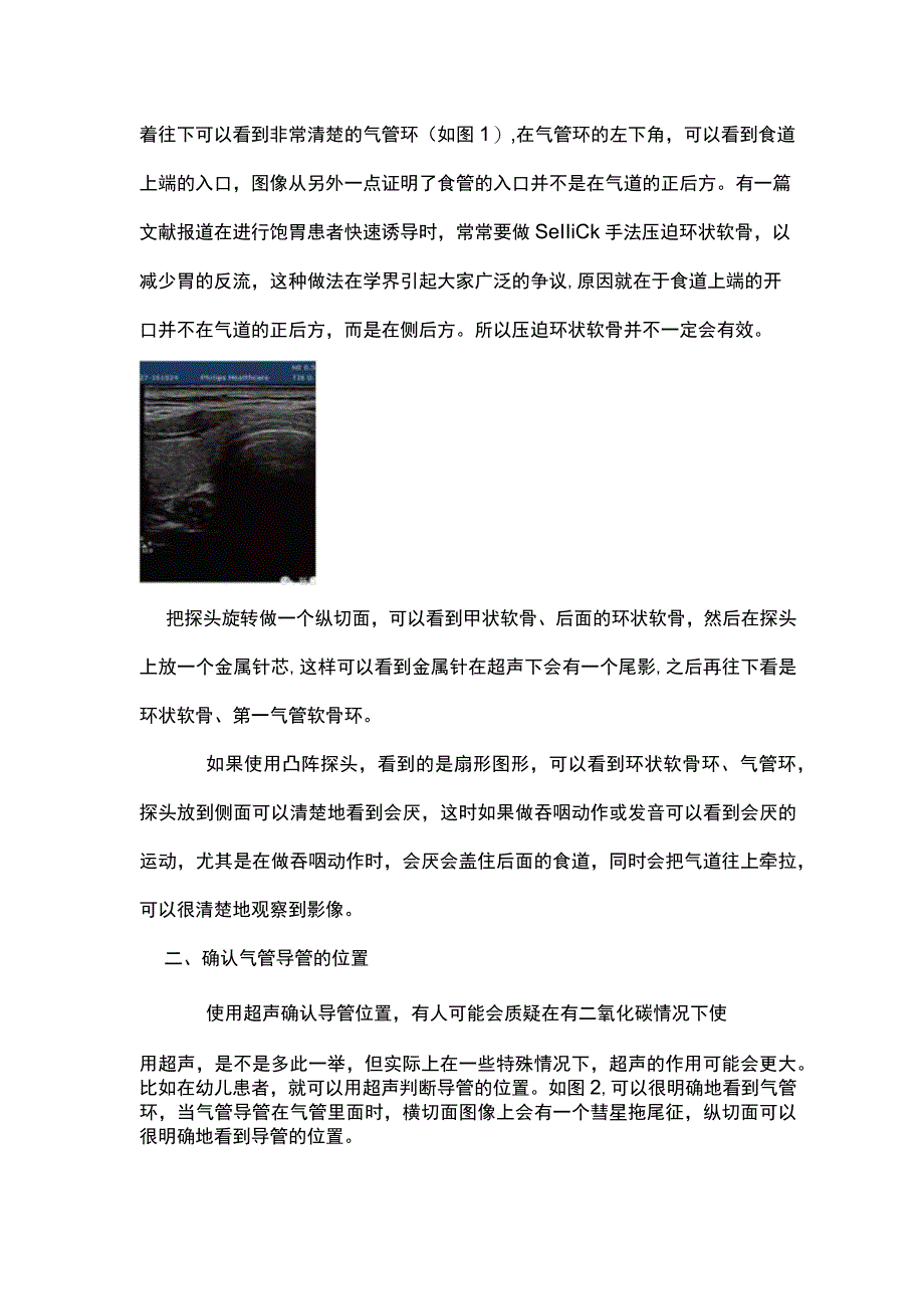 2023超声在气道管理中的应用.docx_第2页