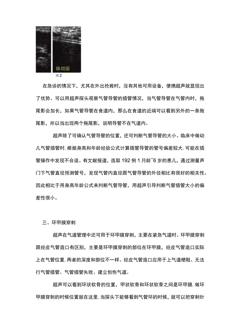 2023超声在气道管理中的应用.docx_第3页