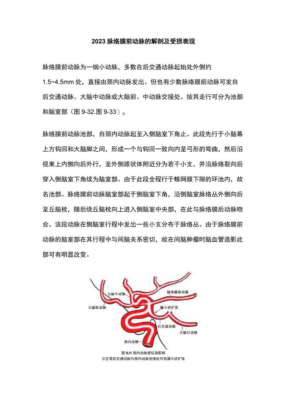 2023脉络膜前动脉的解剖及受损表现.docx_第1页