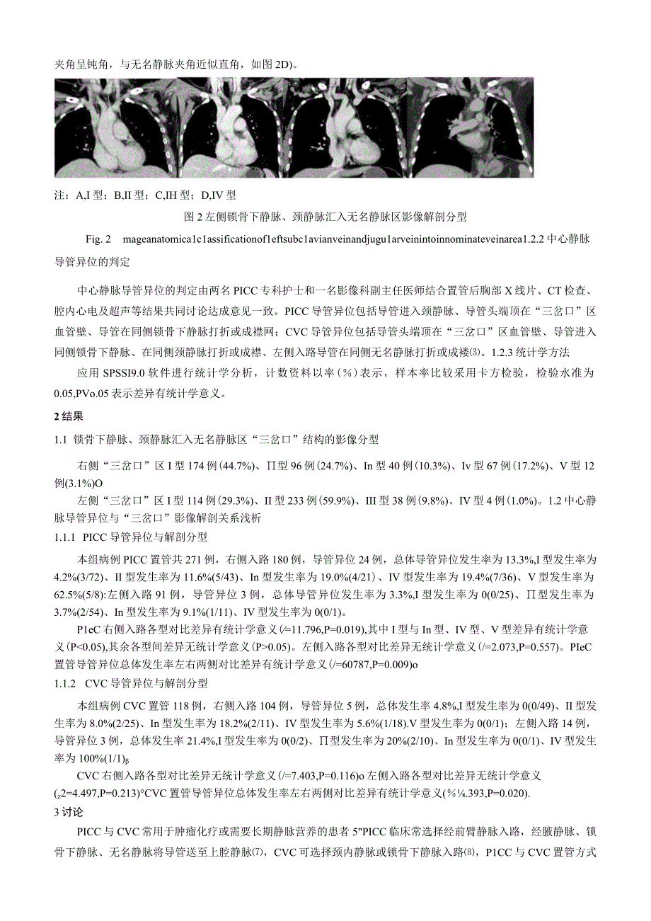 颈静脉、锁骨下静脉汇入无名静脉区的影像解剖分型研究及其在中心静脉置管中的应用浅析.docx_第3页