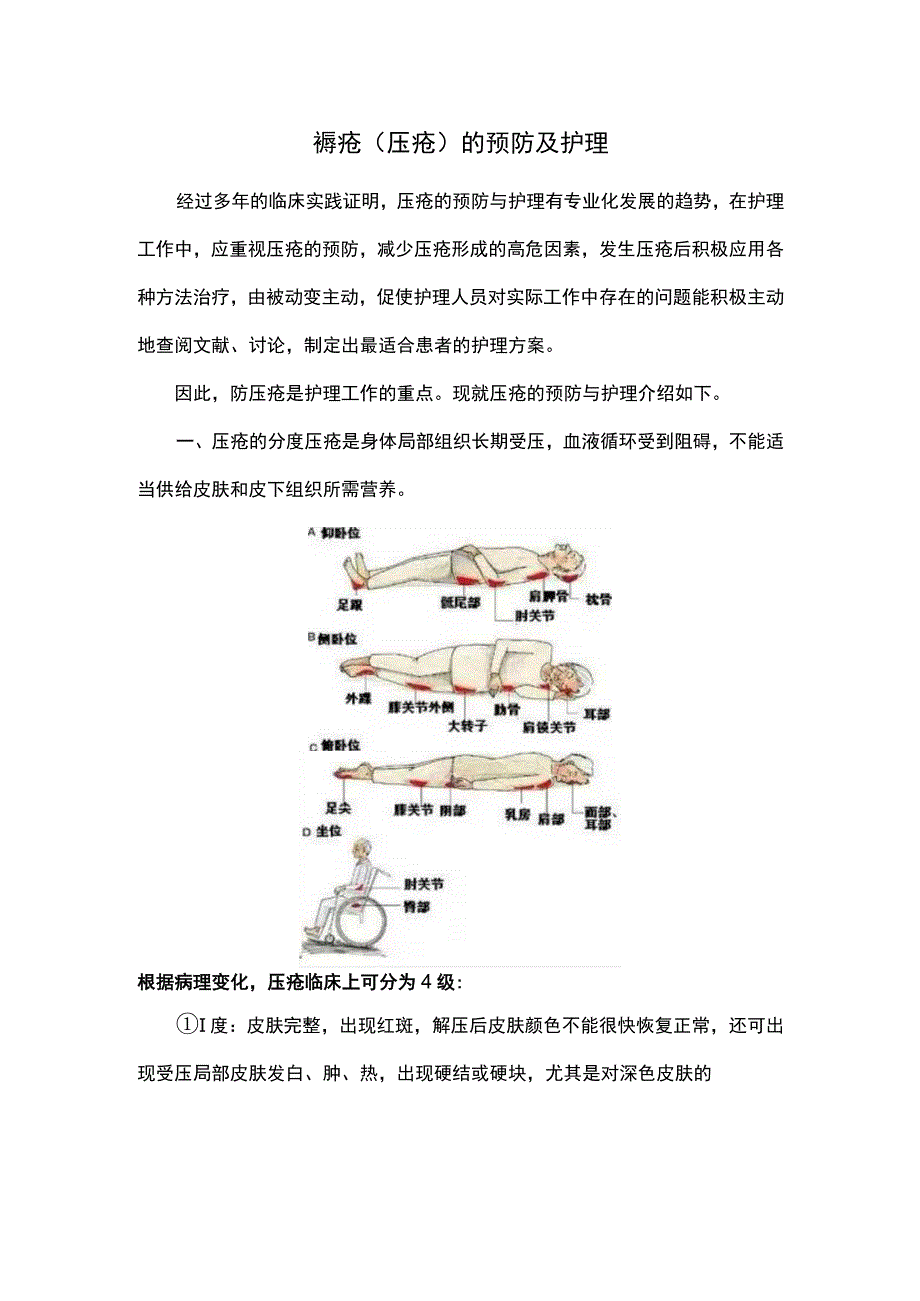 褥疮(压疮)的预防及护理.docx_第1页