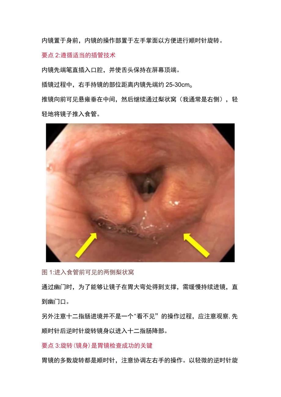 2023胃镜的内镜操作技巧.docx_第2页