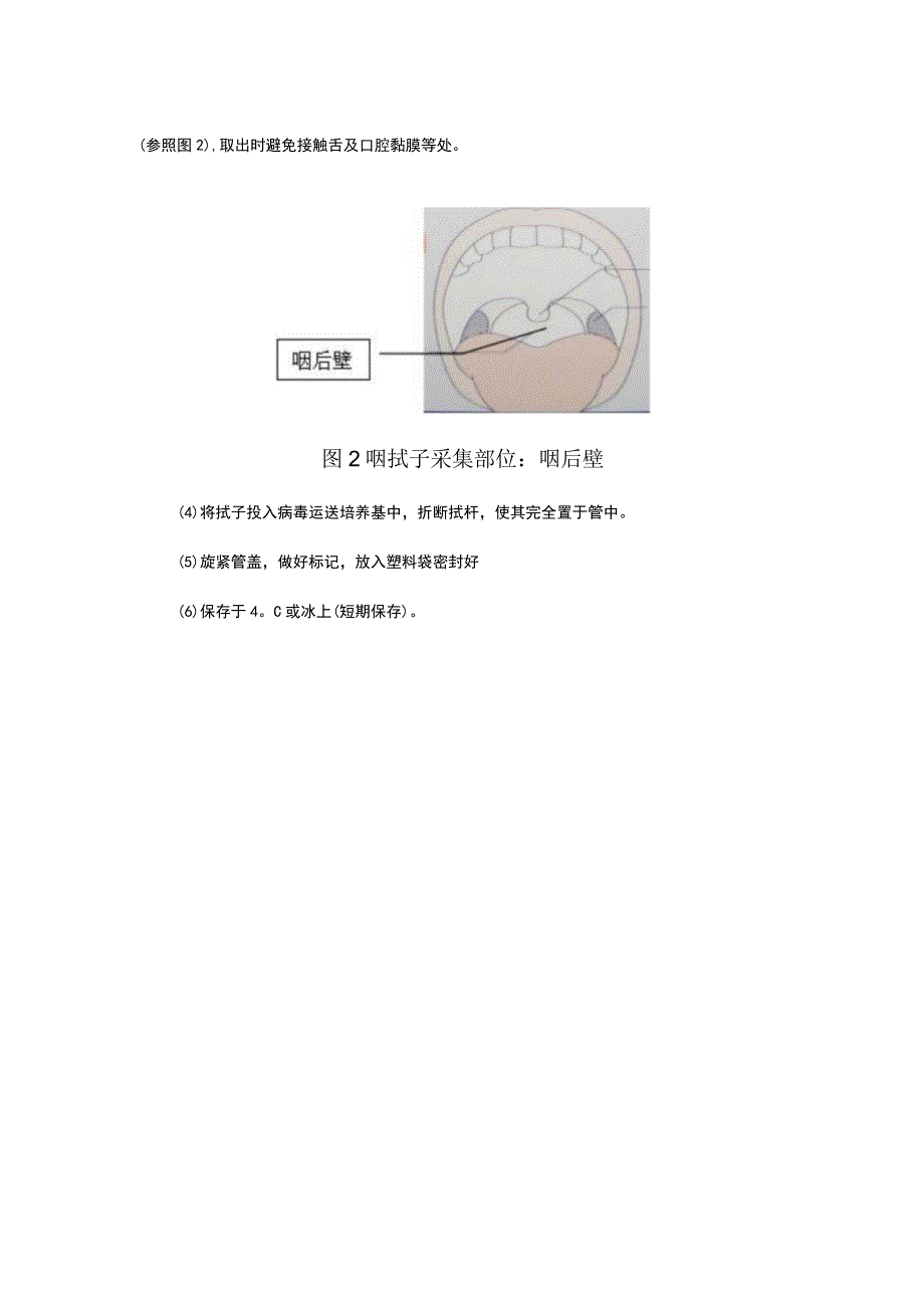 鼻咽拭子标本采集方法、要领及示意图.docx_第2页