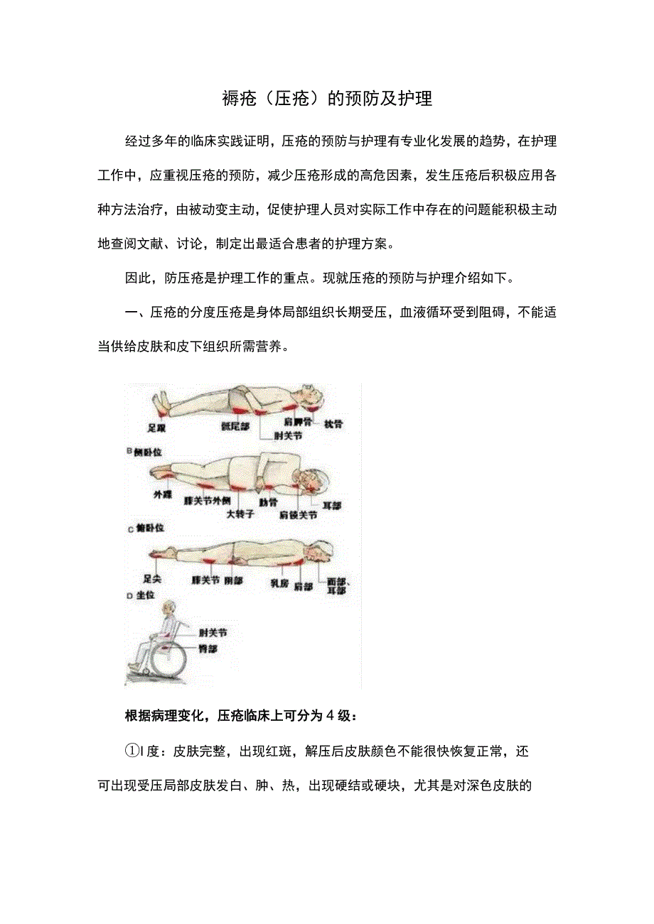 褥疮(压疮)的预防及护理.docx_第1页